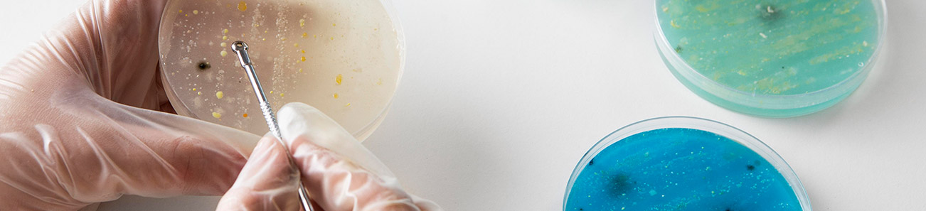 251113_식품환경연구센터_항균・항곰팡이-시험_03